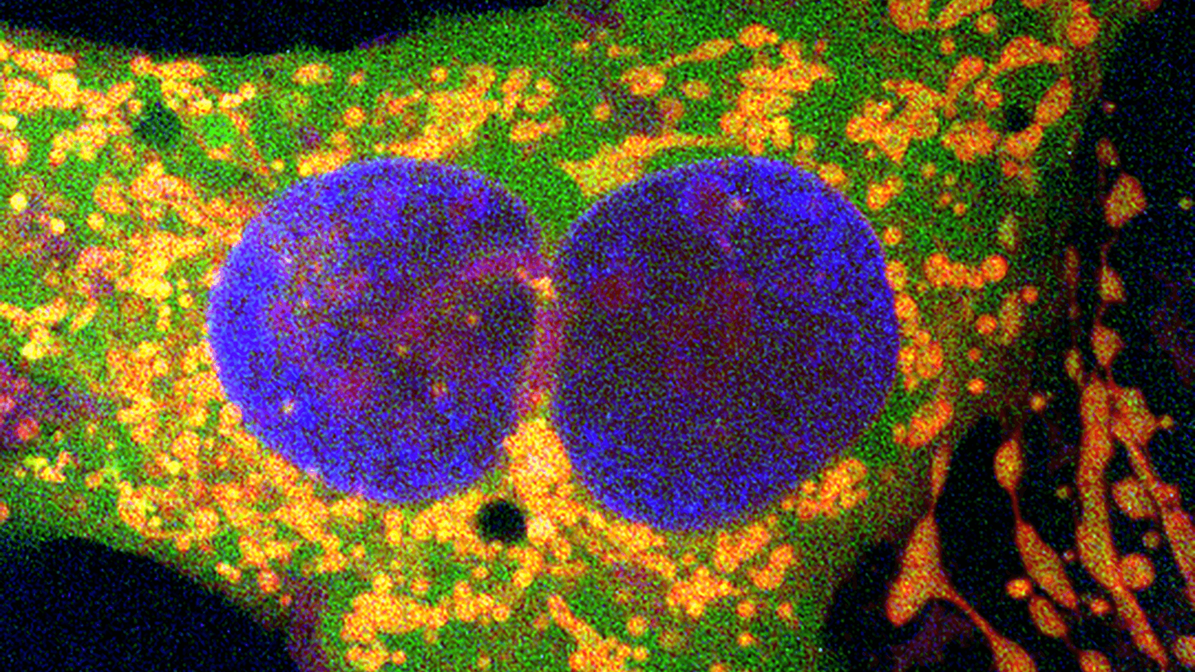 Gene-Editing Breakthrough Offers Hope for Complex Genetic Diseases